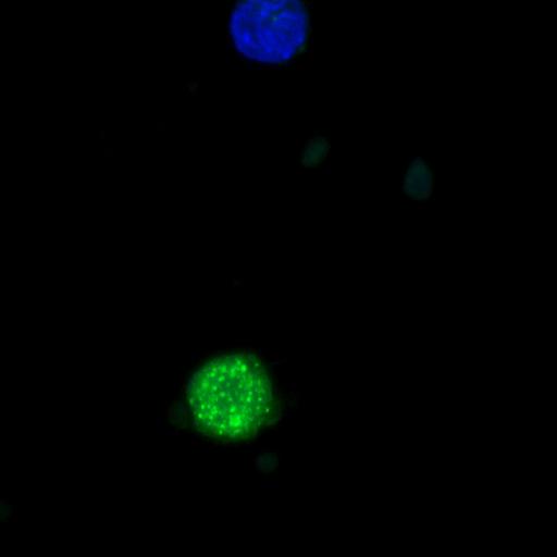  NCBI Organism:Homo sapiens; Cell Types:permanent cell line cell Cell Components:autophagic vacuole Biological process:autophagy