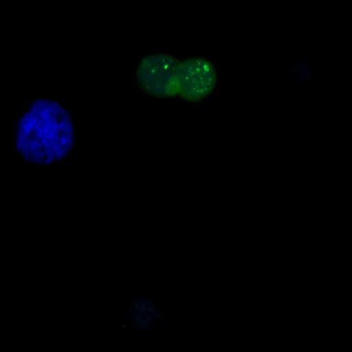  NCBI Organism:Homo sapiens; Cell Types:permanent cell line cell Cell Components:autophagic vacuole Biological process:autophagy