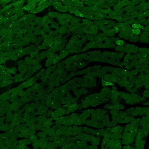  NCBI Organism:Mus musculus; Cell Types:cardiac muscle cell Cell Components:autophagic vacuole Biological process:autophagy