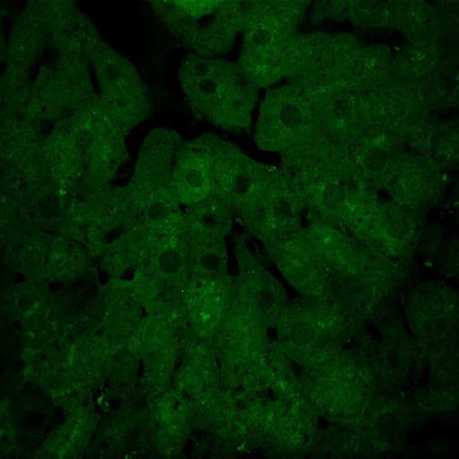  NCBI Organism:Mus musculus; Cell Types:hepatocyte Cell Components:autophagic vacuole Biological process:autophagy