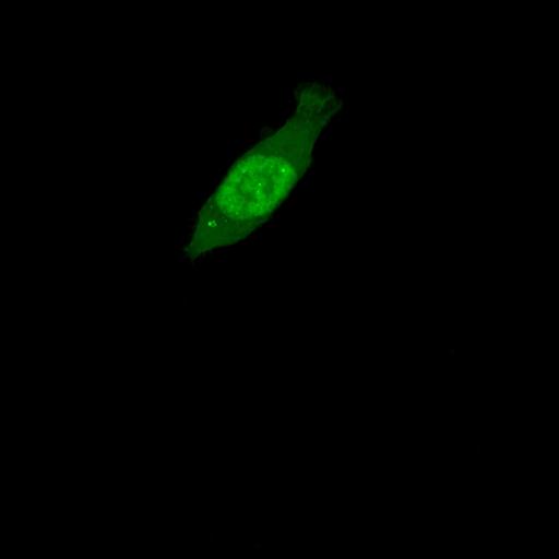  NCBI Organism:Homo sapiens; Cell Types:permanent cell line cell Cell Components:autophagic vacuole Biological process:autophagy