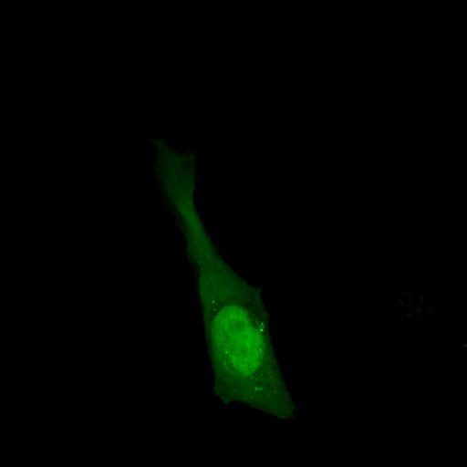  NCBI Organism:Homo sapiens; Cell Types:permanent cell line cell Cell Components:autophagic vacuole Biological process:autophagy