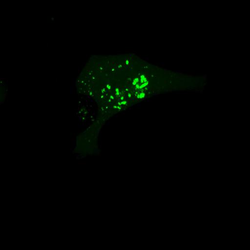  NCBI Organism:Homo sapiens; Cell Types:permanent cell line cell Cell Components:autophagic vacuole Biological process:autophagy