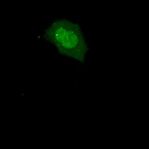  NCBI Organism:Homo sapiens; Cell Types:permanent cell line cell Cell Components:autophagic vacuole Biological process:autophagy