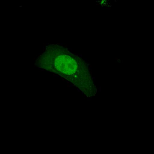  NCBI Organism:Homo sapiens; Cell Types:permanent cell line cell Cell Components:autophagic vacuole Biological process:autophagy