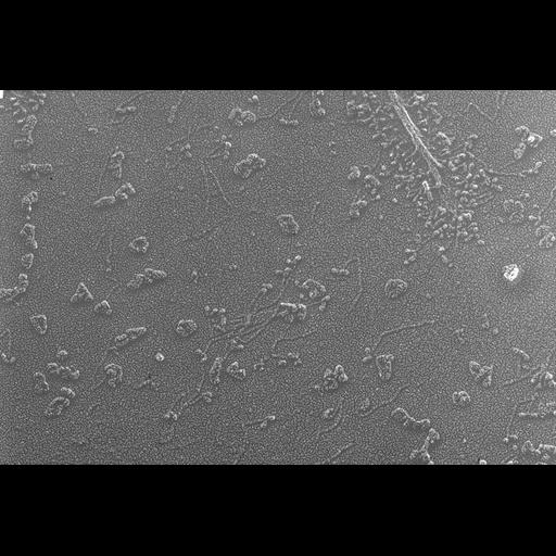  NCBI Organism:Oryctolagus cuniculus; Cell Types:skeletal muscle cell Cell Components:cytoskeleton Biological process:skeletal muscle contraction