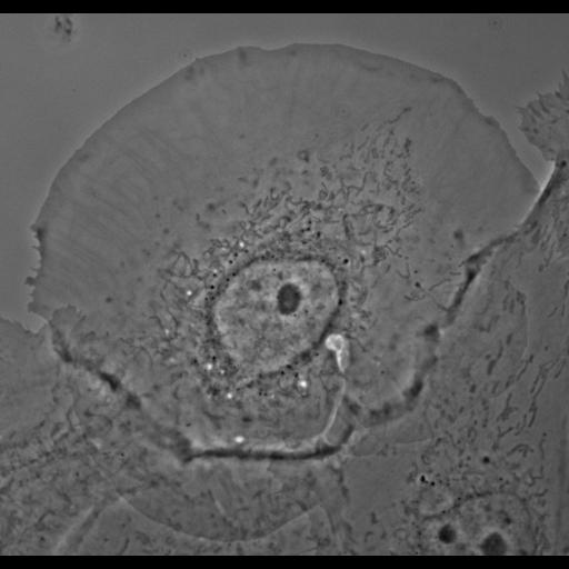  NCBI Organism:Potorous tridactylus; Cell Types:epithelial cell Cell Components:cell, nucleus, lamellipodium, middle lamella;