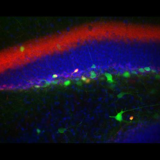  NCBI Organism:Mus musculus; Cell Types:CNS interneuron, hippocampal granule cell; Cell Components:neuronal cell body, dendrite; Biological process:cell communication by chemical coupling, cellular calcium ion homeostasis;