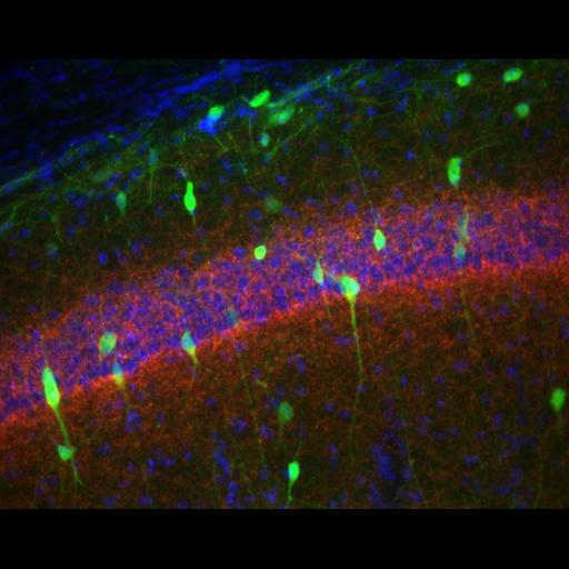  NCBI Organism:Mus musculus; Cell Types:CNS interneuron, pyramidal cell, basket cell; Cell Components:neuronal cell body, nucleus, axon, dendrite; Biological process:cell communication by chemical coupling