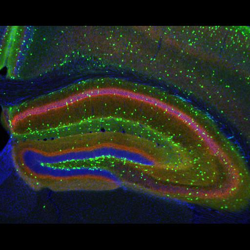  NCBI Organism:Mus musculus; Cell Types:interneuron, hippocampal granule cell, pyramidal cell; Cell Components:neuronal cell body, axon; Biological process:cell communication by chemical coupling