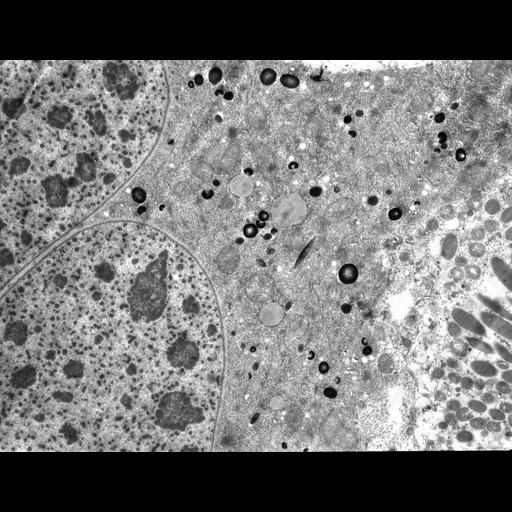  NCBI Organism:Didinium nasutum, Paramecium sp., ; Cell Types:cell by organism, eukaryotic cell, , ; Cell Components:macronucleus, food vacuole, cytoplasm, trichocyst; Biological process:macronucleus organization, response to food, digestion, cytoplasm organization;