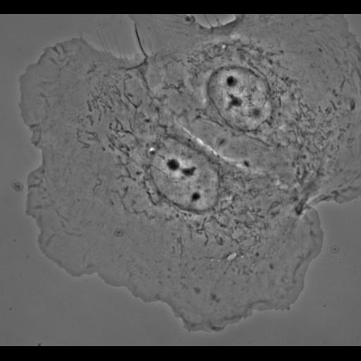  NCBI Organism:Potorous tridactylus; Cell Types:epithelial cell Cell Components:cell, nucleus, lamellipodium, middle lamella;