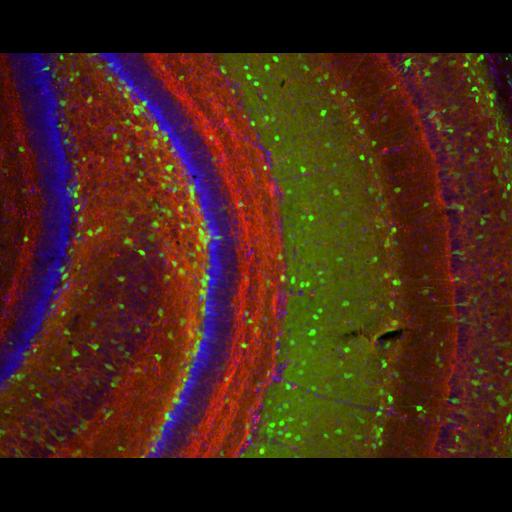  NCBI Organism:Mus musculus; Cell Types:CNS interneuron, hippocampal granule cell; Cell Components:neuronal cell body, axon; Biological process:cell communication by chemical coupling