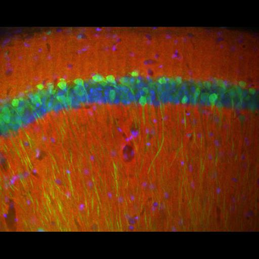  NCBI Organism:Mus musculus; Cell Types:pyramidal cell Cell Components:dendrite, axon; Biological process:regulation of gene expression, cell communication by chemical coupling;