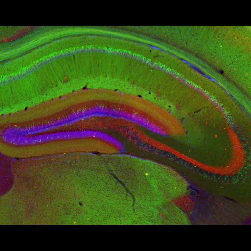  NCBI Organism:Mus musculus; Cell Types:CNS interneuron, pyramidal cell, hippocampal granule cell; Cell Components:axon, dendrite, neuronal cell body; Biological process:cell communication by chemical coupling, cellular calcium ion homeostasis;