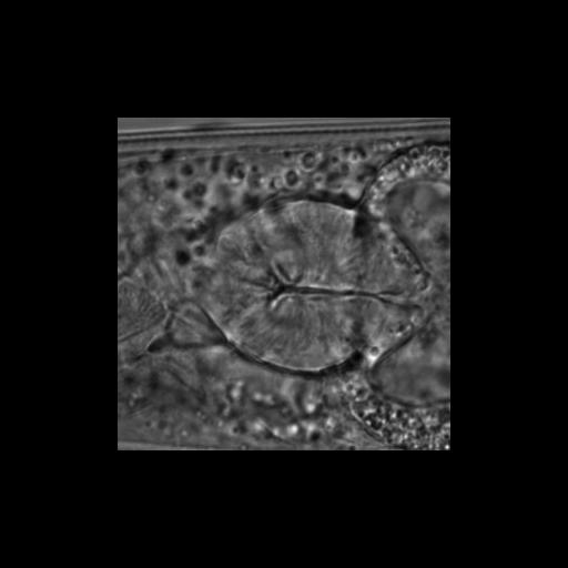  NCBI Organism:Caenorhabditis elegans; Biological process:chronological cell aging