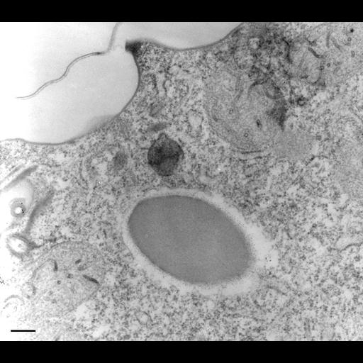  NCBI Organism:Paramecium multimicronucleatum; Cell Types:cell by organism, eukaryotic cell, , ; Cell Components:cell cortex, early endosome; Biological process:cortical cytoskeleton organization, endosome organization;