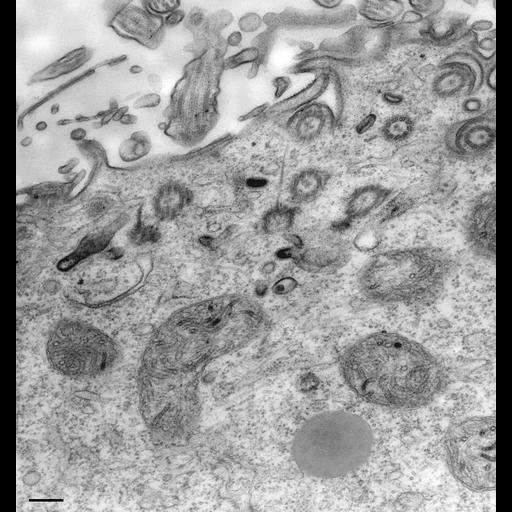  NCBI Organism:Paramecium multimicronucleatum; Cell Types:cell by organism, eukaryotic cell, , ; Cell Components:cell cortex, cortical cytoskeleton, clathrin coat of endocytic vesicle; Biological process:cortical cytoskeleton organization, clathrin coating of Golgi vesicle, plasma membrane to endosome targeting, cytoplasm organization;