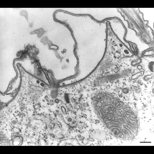  NCBI Organism:Paramecium multimicronucleatum; Cell Types:cell by organism, eukaryotic cell, , ; Cell Components:cell cortex, clathrin coat of endocytic vesicle, cytoplasm, plasma membrane, cortical cytoskeleton; Biological process:clathrin coating of Golgi vesicle, plasma membrane to endosome targeting, plasma membrane organization, cortical cytoskeleton organization;