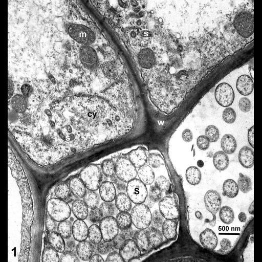  NCBI Organism:Spiroplasma kunkelii, Zea mays, ; Cell Types:plant cell, , prokaryotic cell; Cell Components:mitochondrion, plant-type cell wall; Biological process:pathogenesis