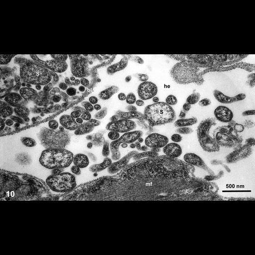  NCBI Organism:Spiroplasma kunkelii, Dalbulus gelbus, ; Cell Types:muscle cell, prokaryotic cell; Cell Components:basal lamina Biological process:pathogenesis