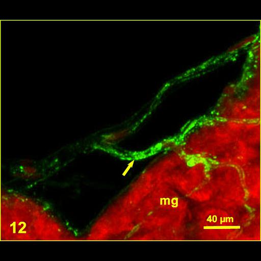  NCBI Organism:Spiroplasma kunkelii, Dalbulus maidis, ; Cell Types:prokaryotic cell Cell Components:nucleus Biological process:pathogenesis