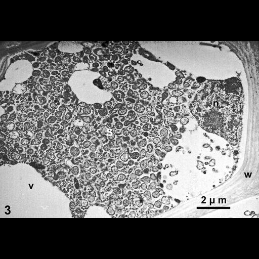  NCBI Organism:Spiroplasma kunkelii, Zea mays, ; Cell Types:plant cell, , prokaryotic cell; Cell Components:plant-type cell wall, plant-type vacuole; Biological process:pathogenesis