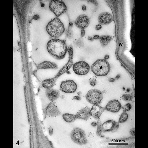  NCBI Organism:Spiroplasma kunkelii, Zea mays, ; Cell Types:plant cell, , prokaryotic cell; Cell Components:plant-type cell wall Biological process:pathogenesis