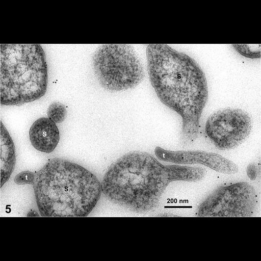 CIL:19127, Spiroplasma kunkelii, Zea mays, plant cell, prokaryotic cell ...