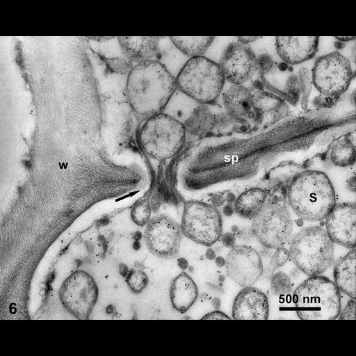  NCBI Organism:Spiroplasma kunkelii, Zea mays, ; Cell Types:plant cell, , prokaryotic cell; Cell Components:plant-type cell wall, pore complex; Biological process:pathogenesis