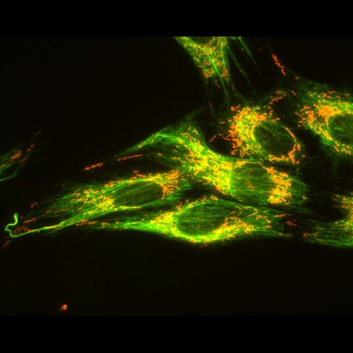  NCBI Organism:Mus musculus; Cell Types:fibroblast Cell Components:type III intermediate filament, mitochondrion; Biological process:intermediate filament-based process, mitochondrion morphogenesis;