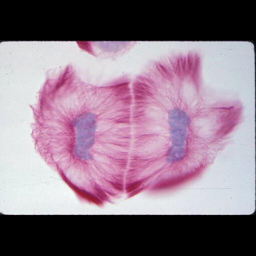  NCBI Organism:Haemanthus katharinae; Cell Components:nuclear chromosome, spindle; Biological process:mitosis