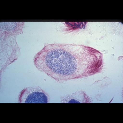  NCBI Organism:Haemanthus katharinae; Cell Components:nuclear chromosome, spindle; Biological process:mitosis