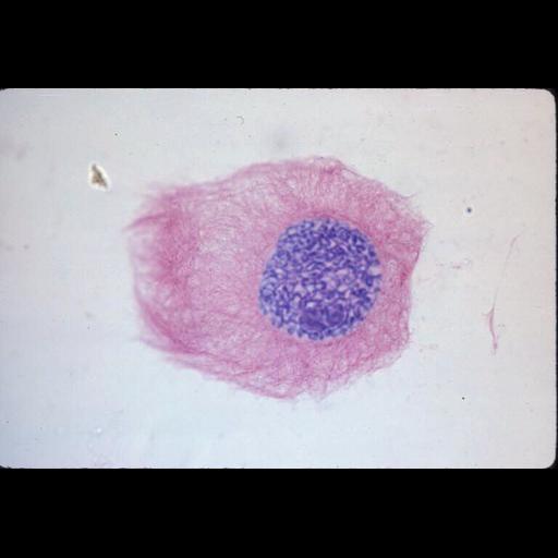  NCBI Organism:Haemanthus katharinae; Cell Components:nuclear chromosome, spindle; Biological process:mitosis