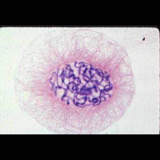  NCBI Organism:Haemanthus katharinae; Cell Components:nuclear chromosome, spindle; Biological process:mitosis