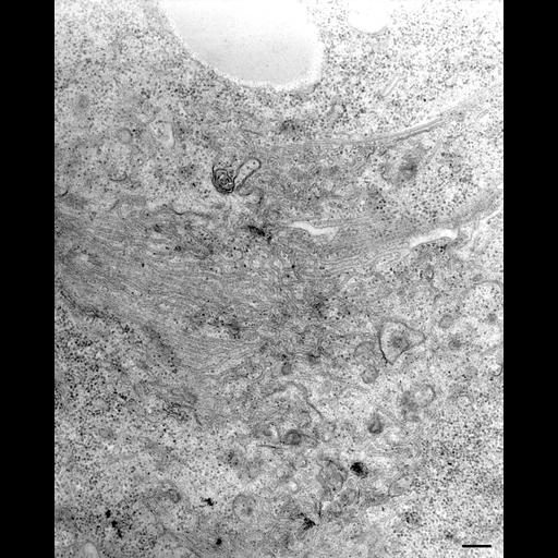  NCBI Organism:Paramecium multimicronucleatum; Cell Types:cell by organism, eukaryotic cell, , ; Cell Components:contractile vacuolar membrane, integral to contractile vacuolar membrane, intrinsic to contractile vacuolar membrane, cytoplasmic microtubule; Biological process:contractile vacuole organization, cytoplasmic microtubule organization;