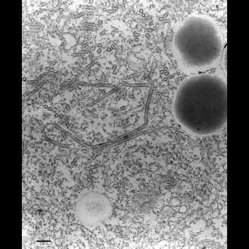  NCBI Organism:Paramecium multimicronucleatum; Cell Types:cell by organism, eukaryotic cell, , ; Cell Components:contractile vacuolar membrane, integral to contractile vacuolar membrane, intrinsic to contractile vacuolar membrane; Biological process:contractile vacuole organization, contractile vacuole discharge;