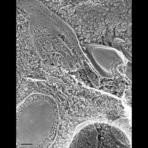  NCBI Organism:Paramecium multimicronucleatum; Cell Types:cell by organism, eukaryotic cell, , ; Cell Components:early endosome, clathrin coat, trichocyst; Biological process:clathrin coat assembly, endosome organization, endosome localization, endosome transport;