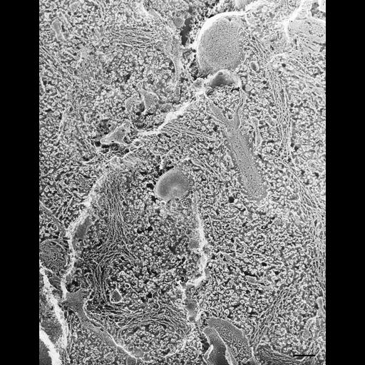  NCBI Organism:Paramecium multimicronucleatum; Cell Types:cell by organism, eukaryotic cell, , ; Cell Components:cytoplasm, coated pit, clathrin vesicle coat, early endosome; Biological process:endosome organization, cytoplasm organization, clathrin coat assembly;