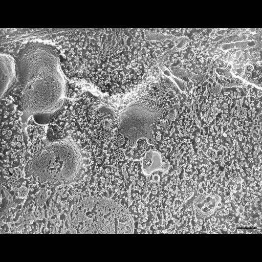  NCBI Organism:Paramecium multimicronucleatum; Cell Types:cell by organism, eukaryotic cell, , ; Cell Components:cell cortex, clathrin coat, , microtubule basal body; Biological process:cortical cytoskeleton organization, endosome organization, cytoplasm organization, microtubule basal body organization;