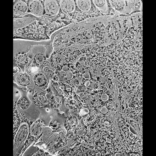  NCBI Organism:Paramecium multimicronucleatum; Cell Types:cell by organism, eukaryotic cell, , ; Cell Components:microtubule basal body, cilium, endosome, clathrin vesicle coat, clathrin coat of coated pit, vesicle membrane; Biological process:cilium movement, endosome organization, cytoplasm organization;