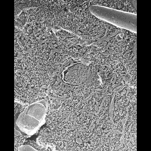  NCBI Organism:Paramecium multimicronucleatum; Cell Types:cell by organism, eukaryotic cell, , ; Cell Components:contractile vacuole, contractile vacuolar membrane; Biological process:contractile vacuole organization