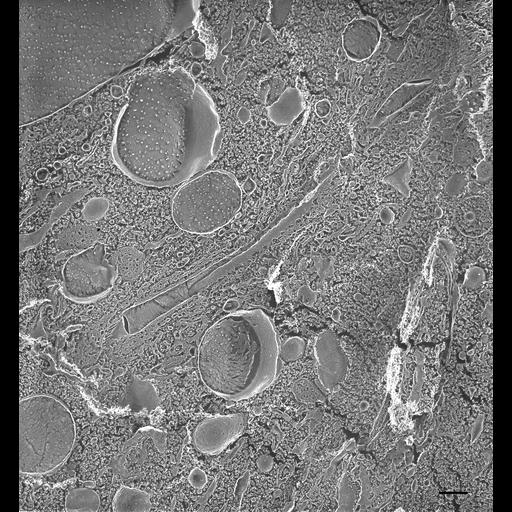  NCBI Organism:Paramecium multimicronucleatum; Cell Types:cell by organism, eukaryotic cell, , ; Cell Components:contractile vacuole, integral to contractile vacuolar membrane; Biological process:contractile vacuole organization