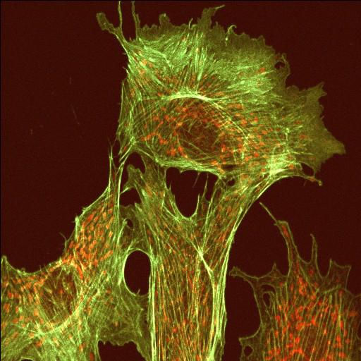  NCBI Organism:Bos primigenius; Cell Types:endothelial cell Cell Components:actin cytoskeleton, microtubule cytoskeleton;