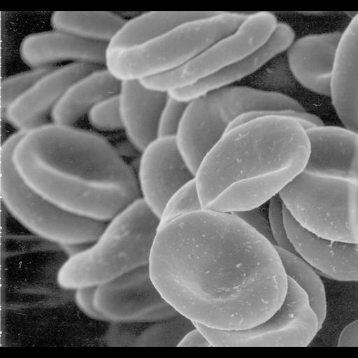  NCBI Organism:Homo sapiens; Cell Types:erythrocyte Biological process:gas transport