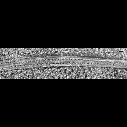  NCBI Organism:Paramecium multimicronucleatum; Cell Types:cell by organism, eukaryotic cell, , ; Cell Components:cilium, radial spoke, axonemal microtubule, cilium axoneme; Biological process:cilium axoneme assembly, cilium movement, cilium assembly;