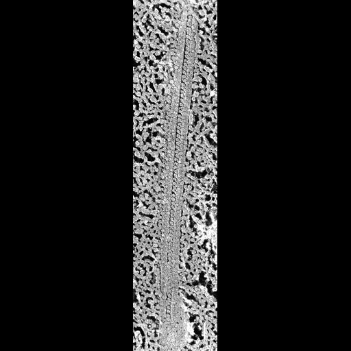  NCBI Organism:Paramecium multimicronucleatum; Cell Types:cell by organism, eukaryotic cell, , ; Cell Components:axonemal dynein complex, axonemal microtubule; Biological process:axonemal dynein complex assembly, microtubule sliding;