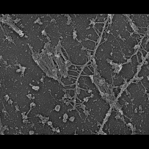  NCBI Organism:Rattus; Cell Types:fibroblast Cell Components:myosin II complex, intermediate filament, ;