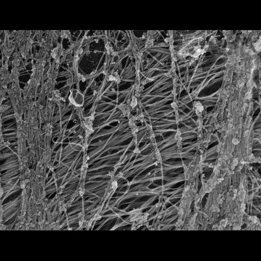  NCBI Organism:Rattus; Cell Types:fibroblast Cell Components:intermediate filament, ; Biological process:, ;