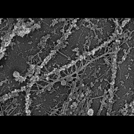  NCBI Organism:Rattus; Cell Types:fibroblast Cell Components:, microtubule, , intermediate filament;